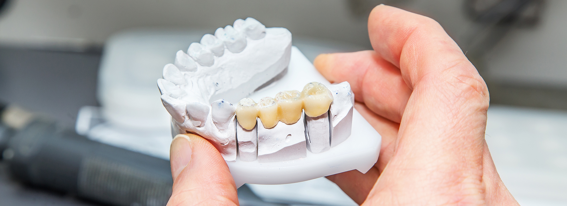 The image shows a person holding a model of a human mouth, likely for dental or orthodontic purposes.