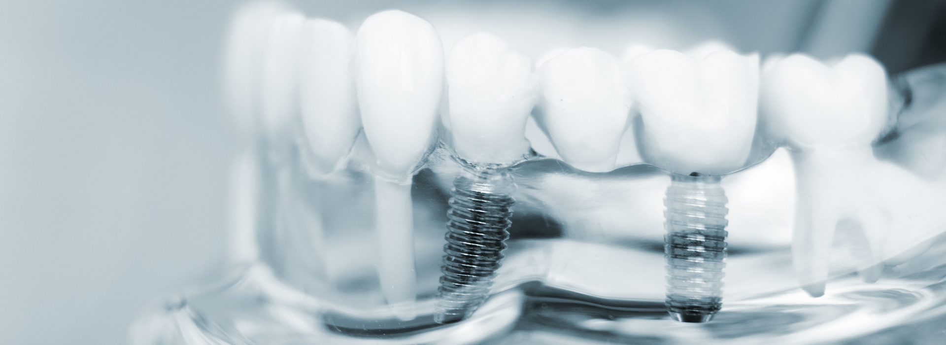 The image shows a close-up of multiple toothbrushes with bristles in focus, placed on a clear background that allows the bristles to be seen clearly.