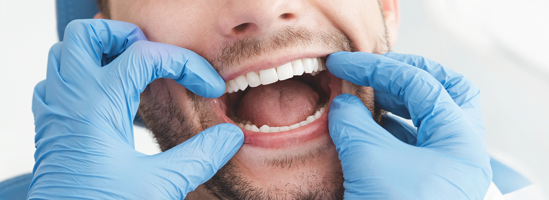 A man in a dental mask holding up his mouth with two hands, displaying a wide smile.