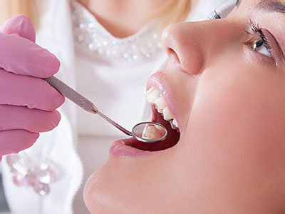 Dental hygienist using dental tools to clean teeth.